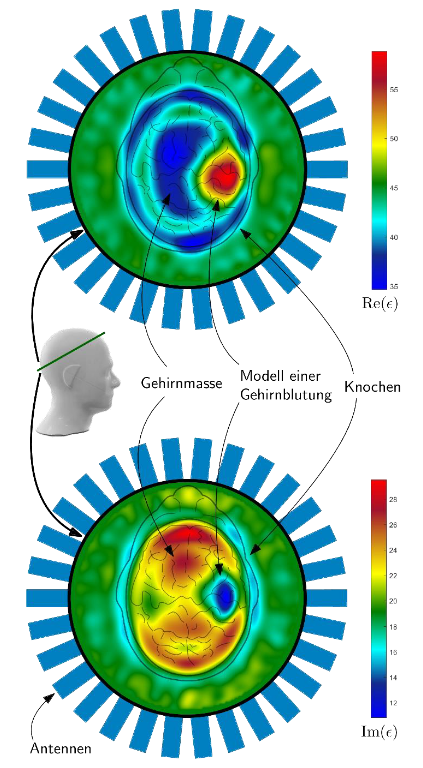 Bild Post Simulationsergebnis eines Kopfmodells